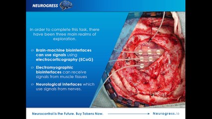 Would you like to be a Cyborg?