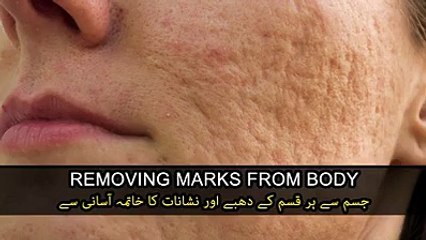 Naturally remove all marks from your body