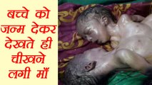 Bihar में mother ने दिया अजीबो-गरीब बच्चे को जन्म, देखते ही सभी हो गए हैरान । वनइंडिया हिंदी