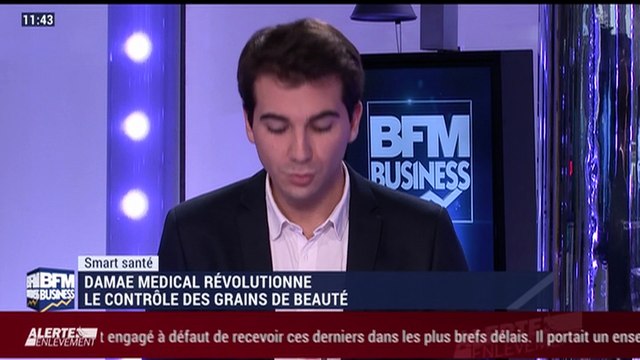 Smart Santé: Damae Medical révolutionne le contrôle des grains de beauté - 06/01