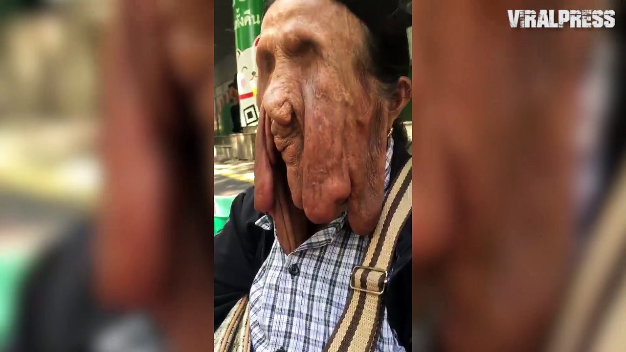 Thai Grandmother’s Face Is Melting