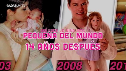 Así luce la niña más pequeña del mundo 14 años después. Los doctores no pueden creerlo