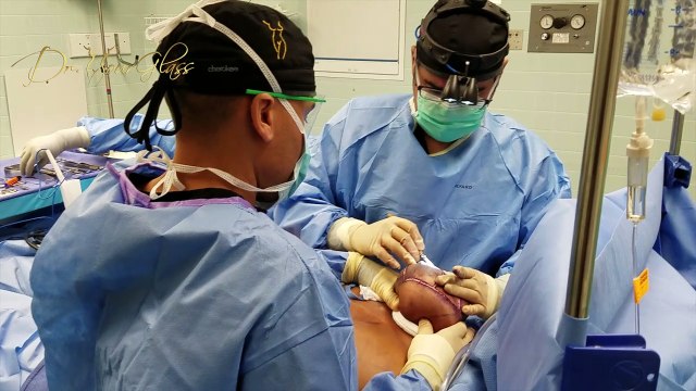 Breasts Imperfections That Determine The Need for Plastic Surgery