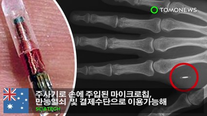 주사기로 손에 주입된 마이크로칩, 만능열쇠  및 결제수단으로 이용가능해