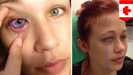 目から紫の涙…目のタトゥーに失敗したモデル女性  - トモニュース