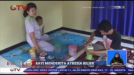 Bayi Derita Atresia Bilier Butuh Biaya Rp1 Miliar