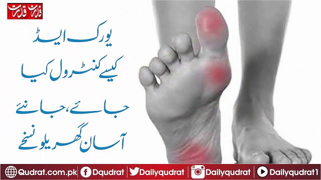 remedies-to-control-uric-acid