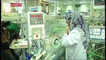 Yapışık ikizler Riyad'da yapılan ameliyatla ayrıldı