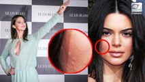 Kendall Jenner Gives A PERFECT REPLY For Body Shaming Over Her Acne!