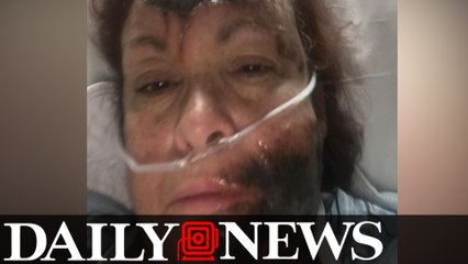 Woman attacked with caustic spray on Staten Island