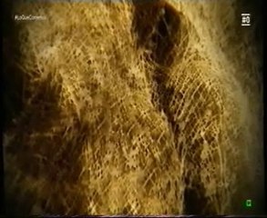 Nutricion: El calcio lacteo (Intolerancia a la lactosa)