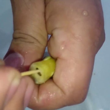 Ce poisson couve ses oeufs dans sa bouche et on a l'impression qu'il accouche par la bouche