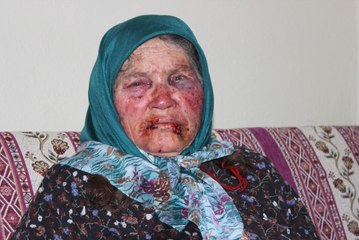 Oğlunun Arkadaşıyım' Diye Kapıyı Çalıp Yaşlı Kadını Öldüresiye Dövdü