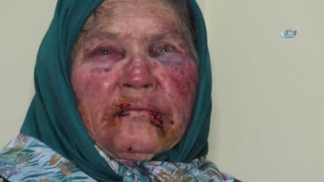 Oğlunun Arkadaşıyım' Diye Kapıyı Çalıp Yaşlı Kadını Öldüresiye Dövdü