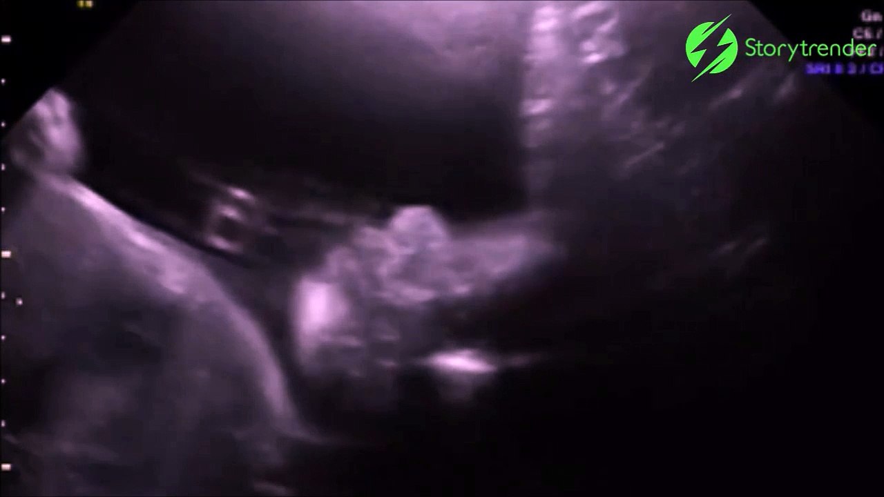 Quand ton bébé te fait coucou depuis l'interieur de ton ventre... Adorable