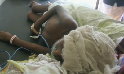 Kemenkes Kirim Tim untuk Atasi Wabah Campak di Papua