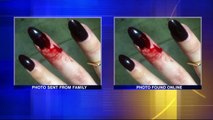 Student Apologizes for Using Fake Photo of Injury From Fight School Staff Member Allegedly Facilitated