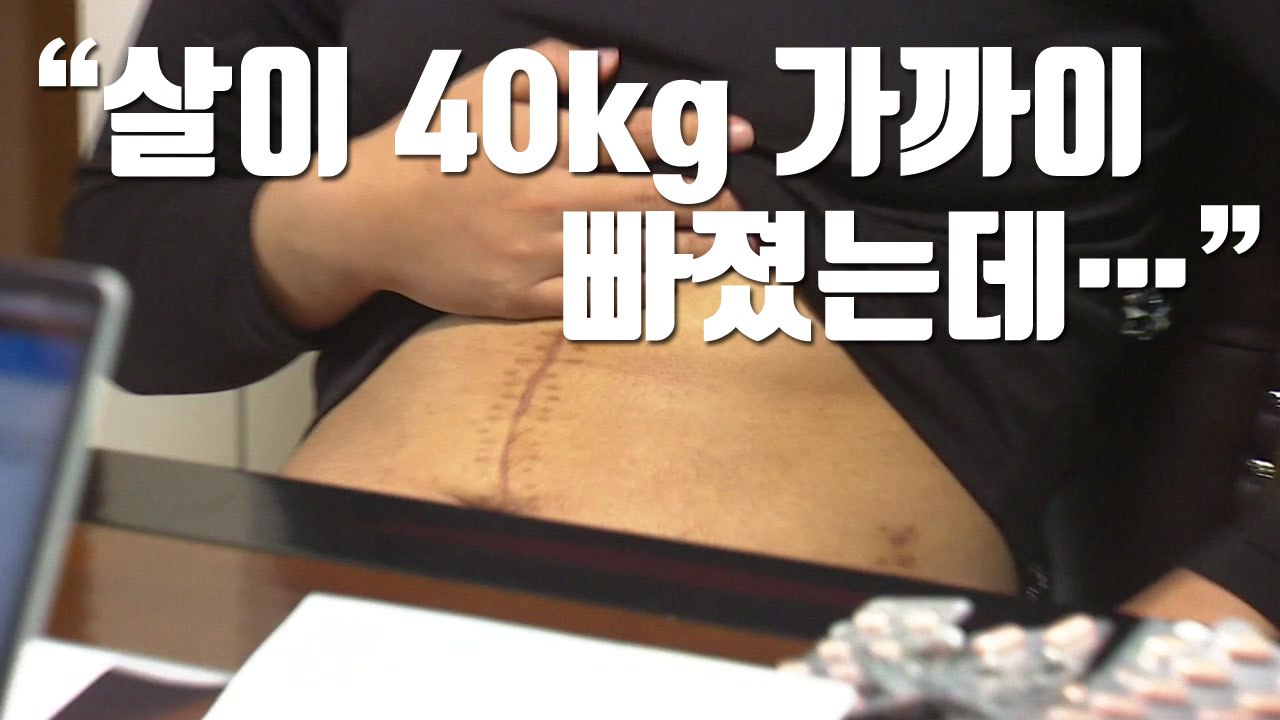 [자막뉴스] 춘천소년원, 대장암 10대 방치 논란 / YTN
