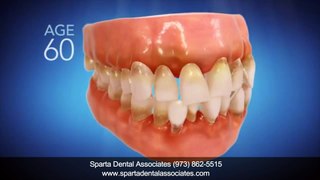 Invisalign Dentist Sparta Township NJ