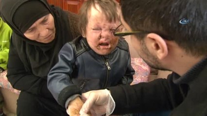 Savaşın Yaktığı Minik Bedenler Antalya'da Hayata Tutundu