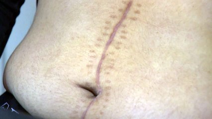 [단독] "40kg 가까이 빠졌는데 변비라며..." 춘천소년원 대장암 10대 방치 논란 / YTN