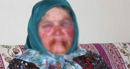 Yaşlı Kadını Dövüp Altınlarını Çalan 3 Maganda, Gözaltına Alındı