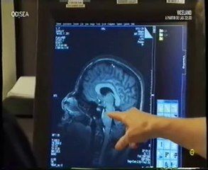 Amor y cerebro: Jovenes vs. mayores (Amor a largo plazo, Helen Fisher)