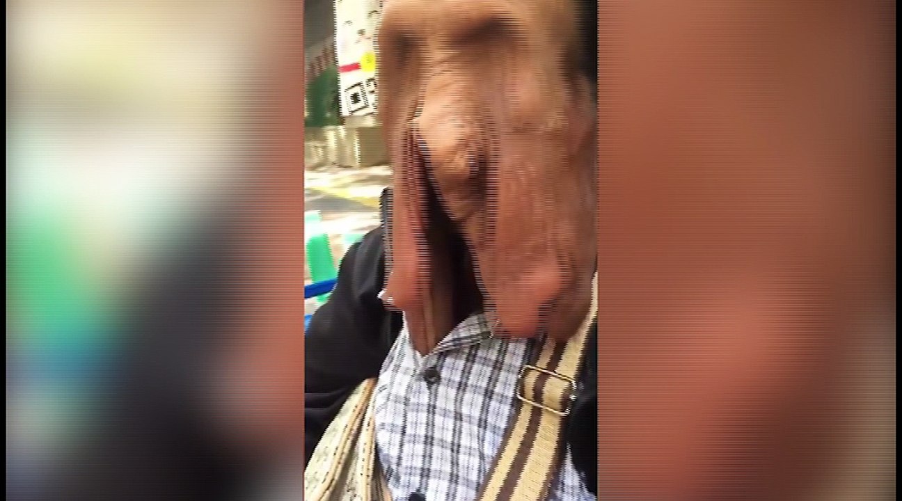 Elle a la peau qui fond sur son visage