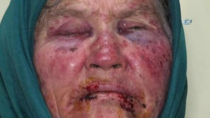 Yaşlı Kadının Darp Edilmesinde Kullanılan Bant ve Bardak Kriminal İncelemeye Gönderildi