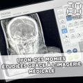 Lyon: Des momies étudiées grâce à l'imagerie médicale