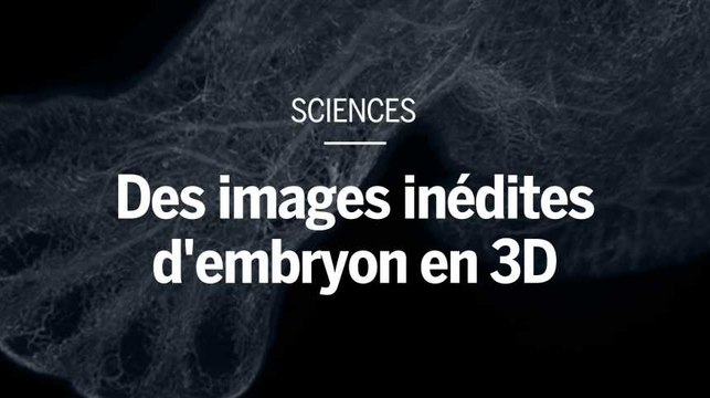 Des images inédites d'embryons et de fœtus humains