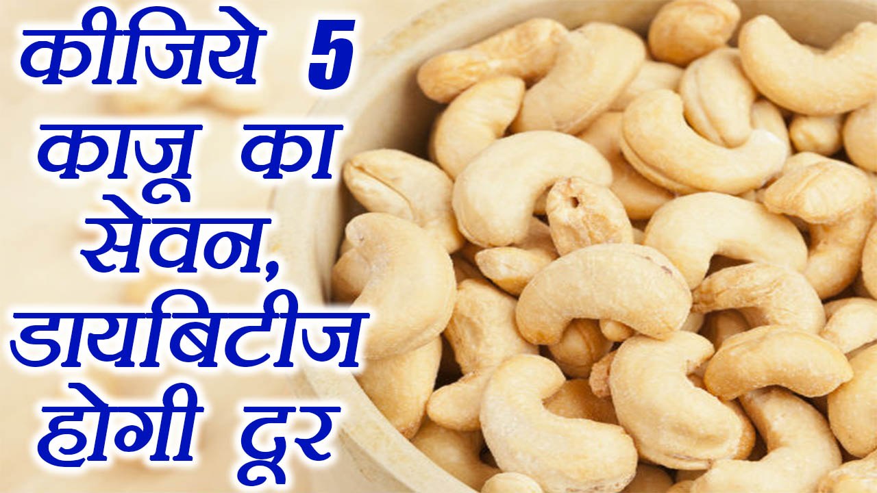 डायबिटीज़ जैसी बड़ी बीमारियों को दूर रखता है काजू | Benefit of Cashew nuts | Boldsky