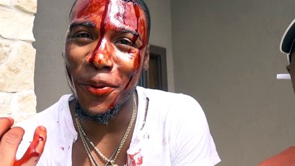 "I GOT BEAT UP" PRANK ON TREY AND QUEEN!!!