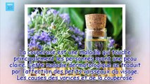 3 remèdes à base de plantes pour traiter les varices et la couperose - France 365