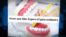 Types of Cosmetic Dentistry Procedure - Smilesbyjosh.com