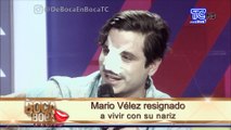 Mario Vélez resignado a vivir con lo sucedido en su nariz