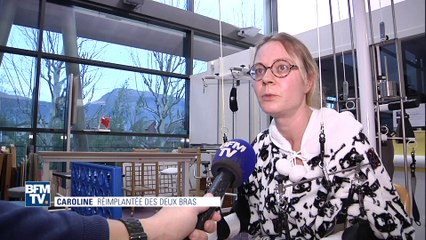 Victime d'un grave accident, elle a été greffée des deux bras