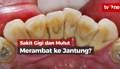 Sakit Gigi dan Mulut, Merambat ke Jantung?