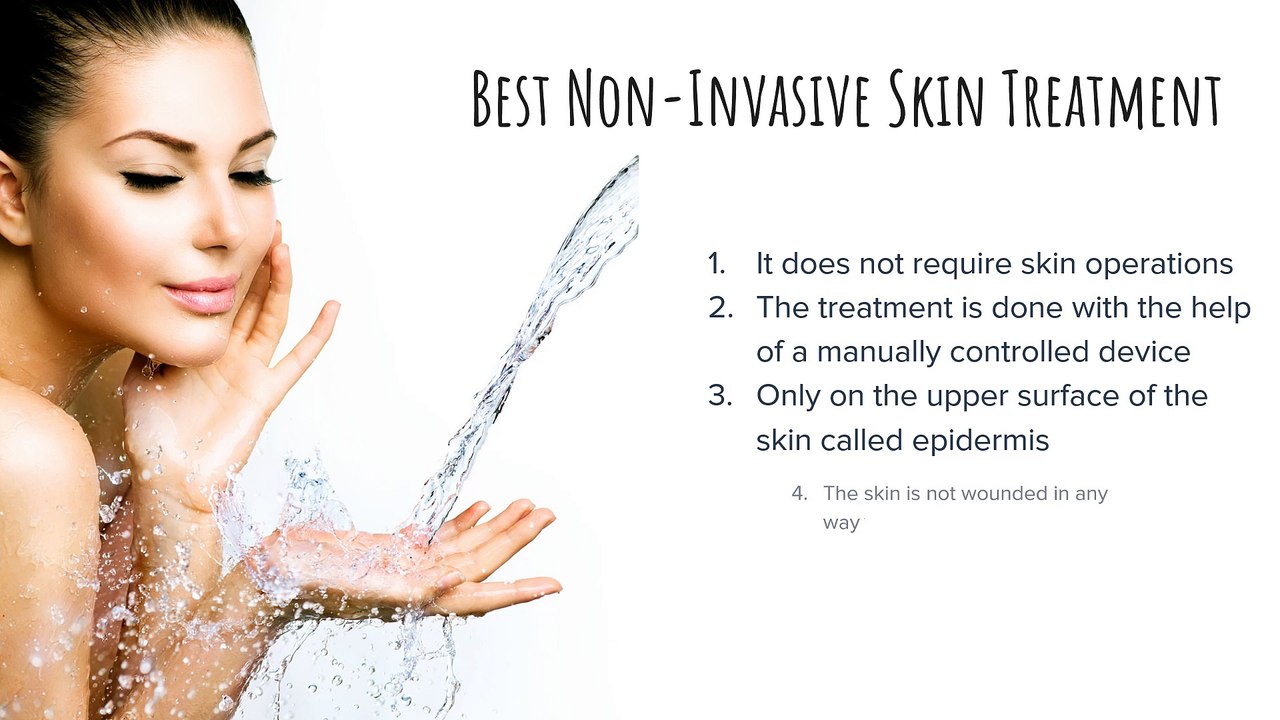 Microdermabrasion - The Best Skin Treatment