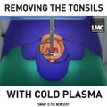 What happens in an operation to remove someone's tonsils. The author of the video is Light Matters CreativeThe laser shown here is sold by the company Smith
