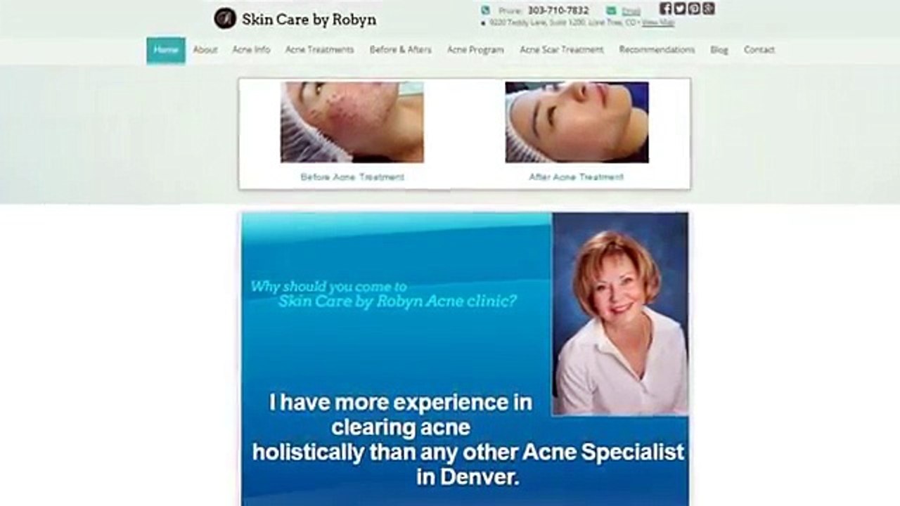 Microneedling Denver CO