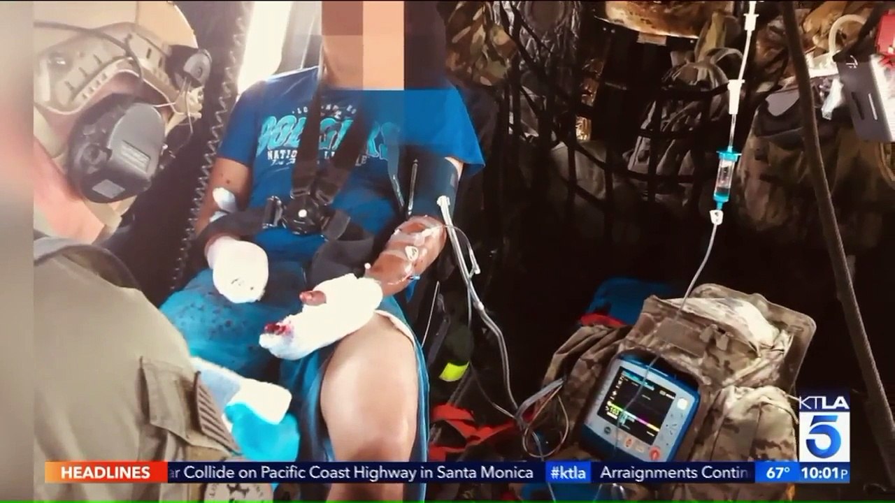 Man Seriously Injured After Illegal Firework Explodes in His Hands