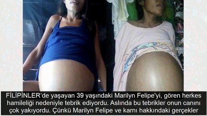 Göbeğini gören herkes hamileliğini tebrik etti ama işin aslı başka
