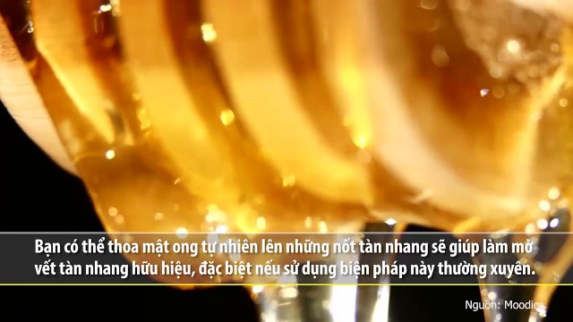 Bí quyết trị tàn nhang từ 9 nguyên liệu thiên nhiên quen thuộc