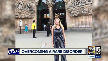 University of Arizona student diagnosed with Guillain–Barré syndrome to be released from hospital