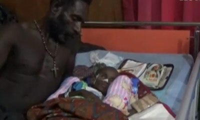 Seorang Ayah Dampingi Anaknya yang Dirawat Karena Gizi Buruk