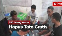 Ratusan Orang Antre Ikuti Acara Hapus Tato Gratis