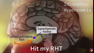 Im Not Awake (Idiopathic Hypersomnia)