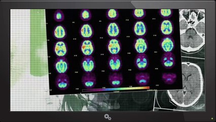 How Does Human Memory Work Documentary 2017