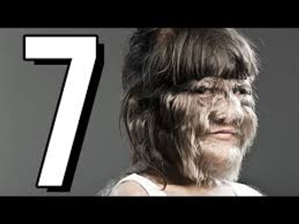 7 wyjątkowo dziwnych i przerażających CHORÓB  DRASTYCZNE
